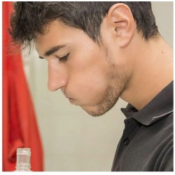 افالون افوهيكس 0.2% غسول للفم | 300مل