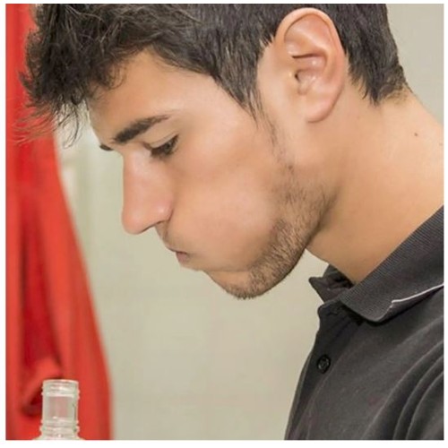 افالون افوهيكس 0.2% غسول للفم | 300مل